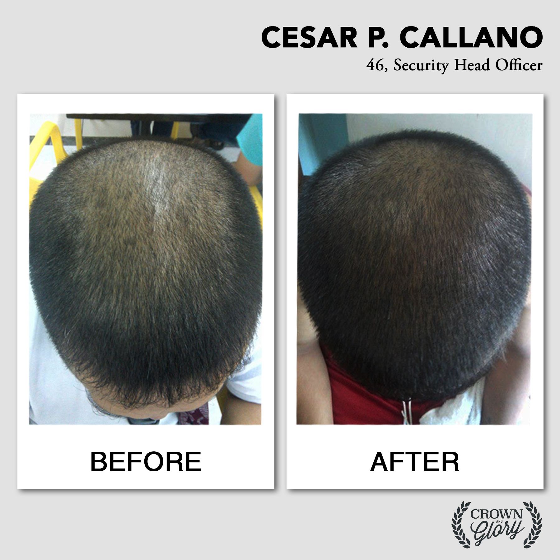 hair grower testimonial