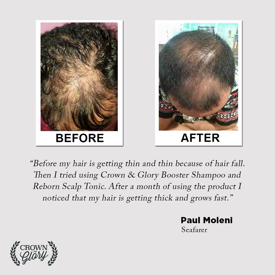 hair grower testimonial