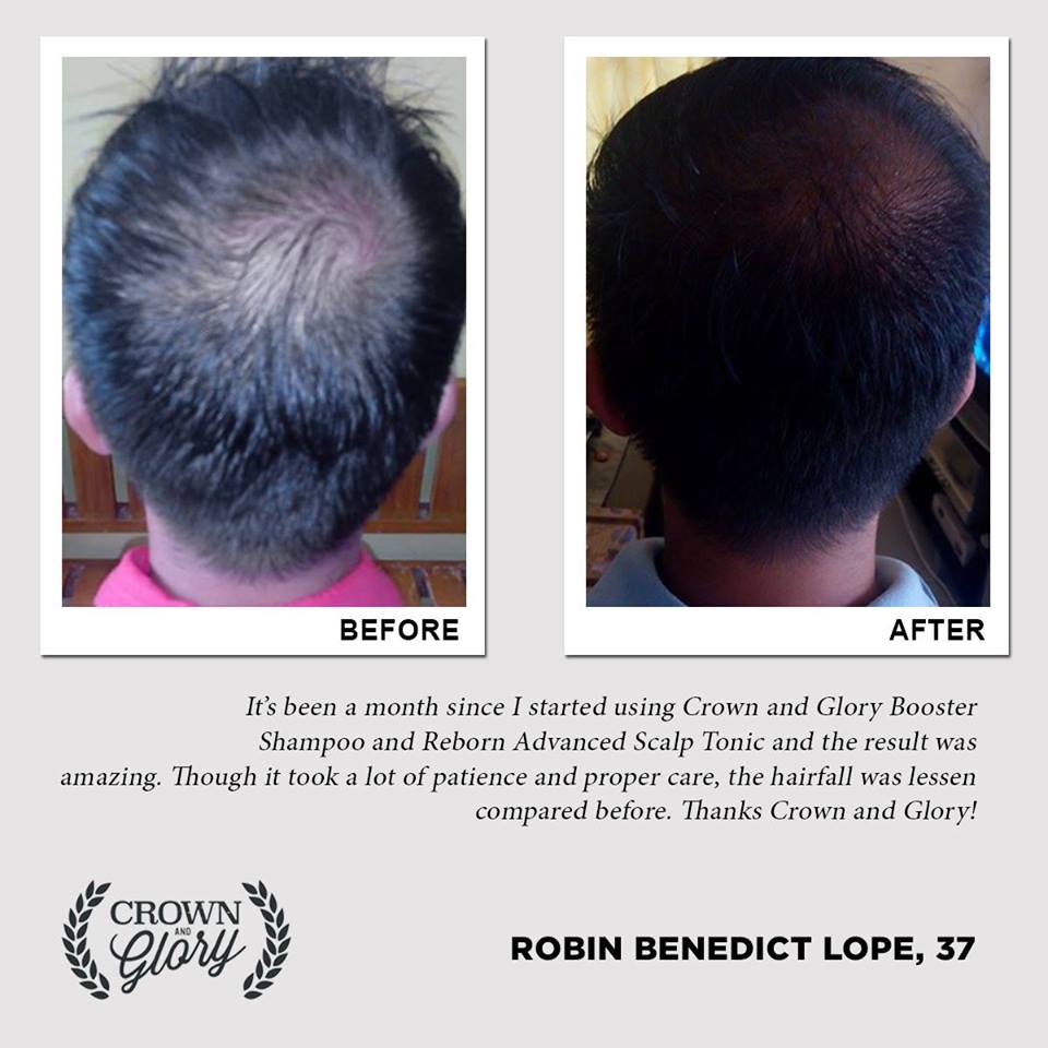 hair grower testimonial