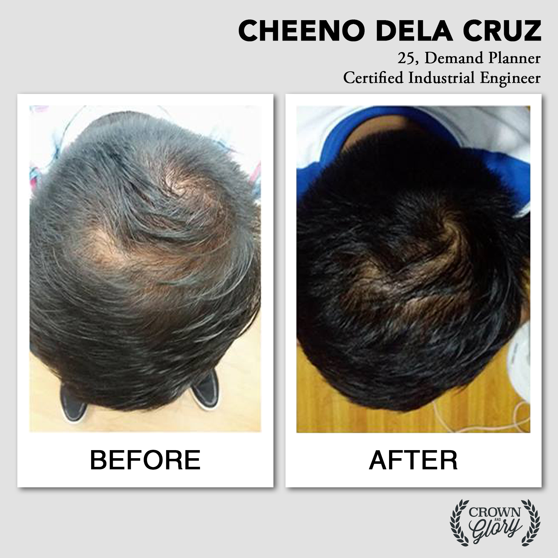 hair grower testimonial