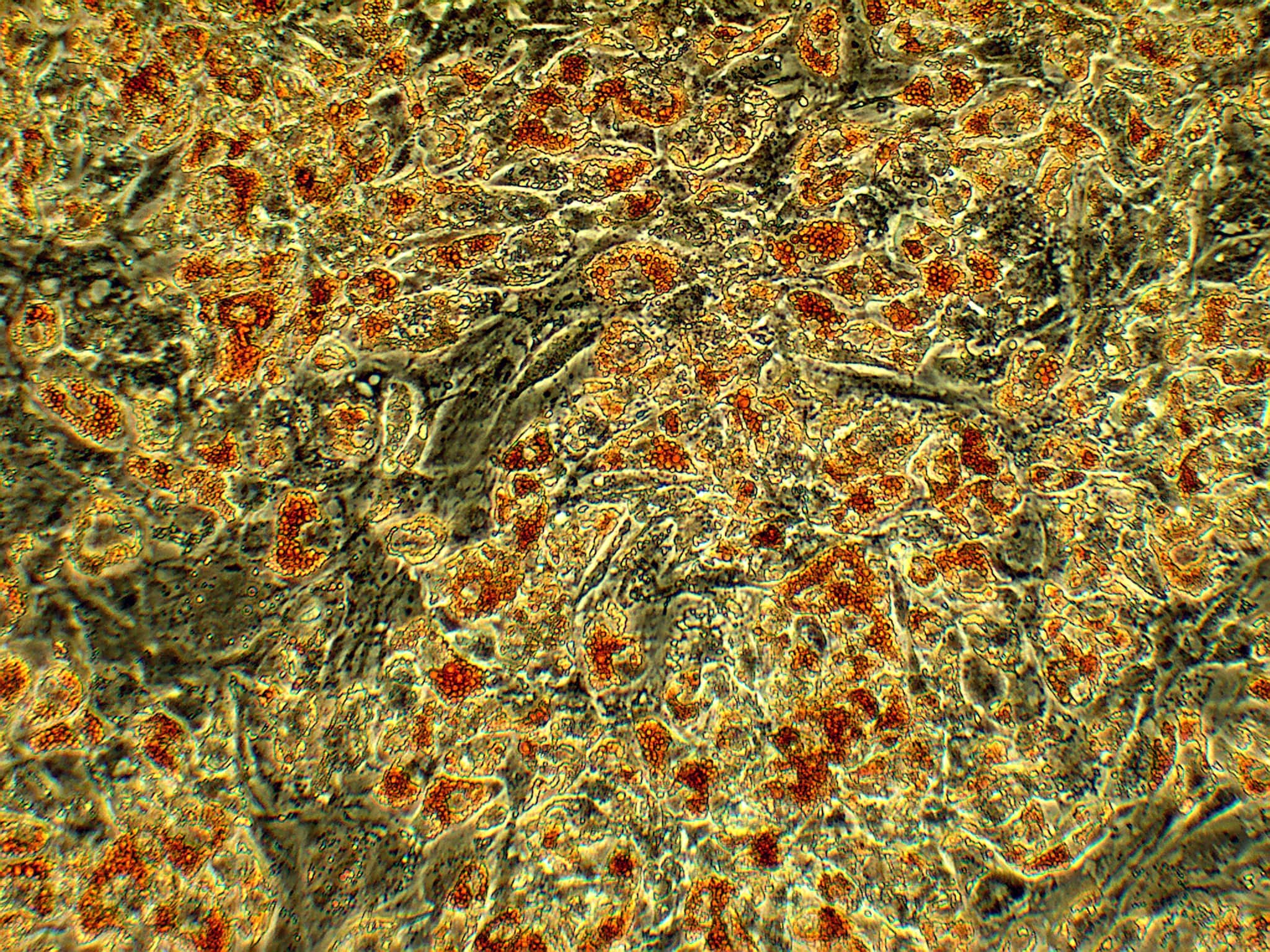 Microscope Photos of Adipogenic Differentiation of Mesenchymal Stem Cells with White Background