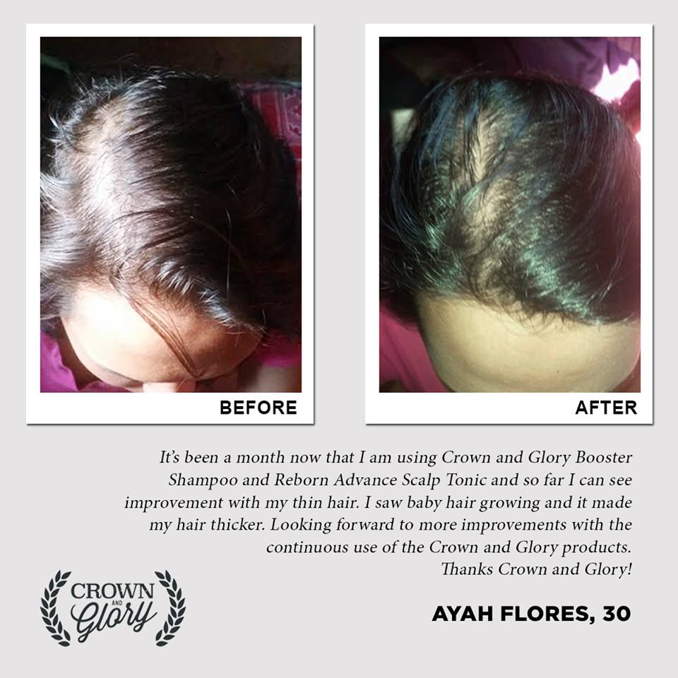 hair grower testimonial