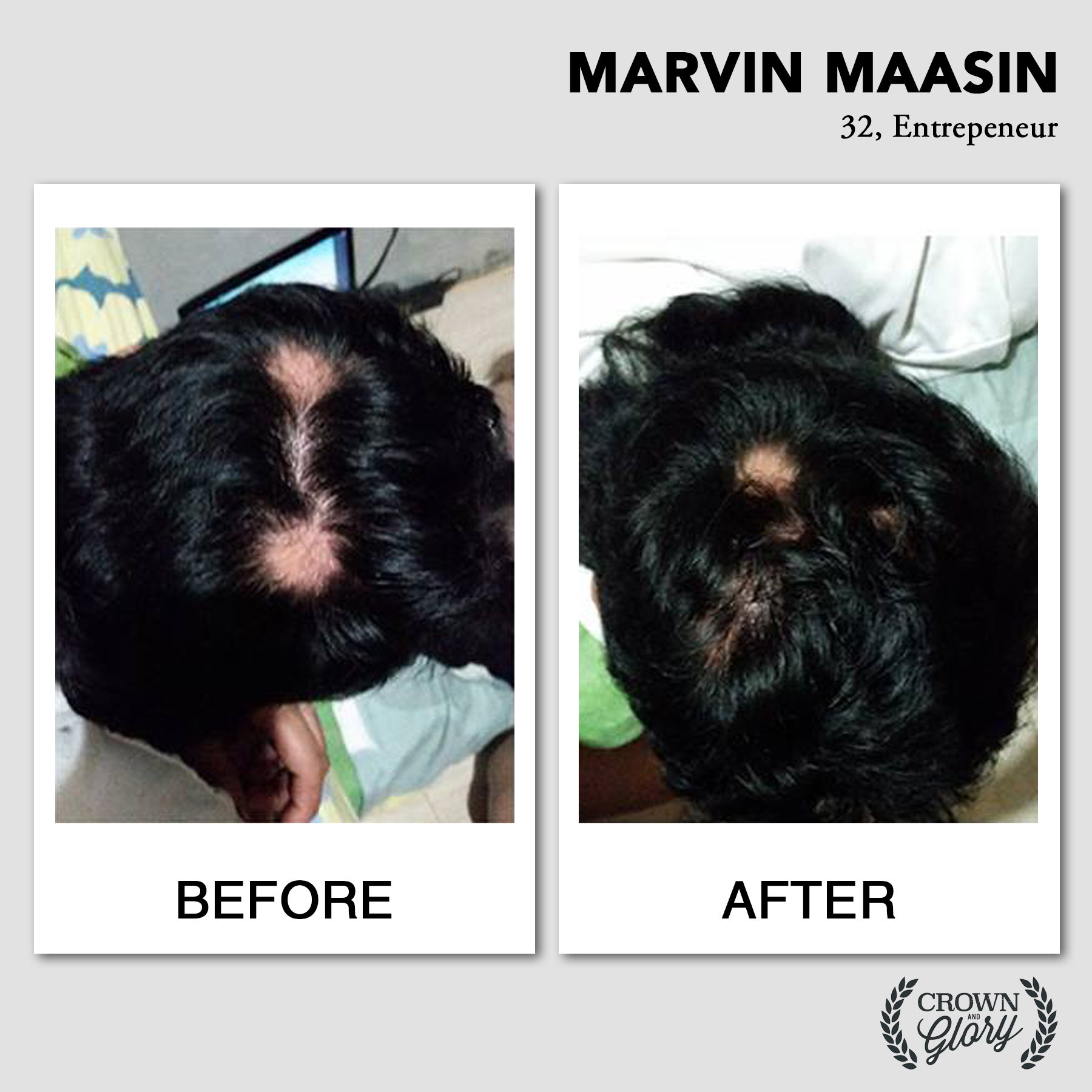 hair grower testimonial