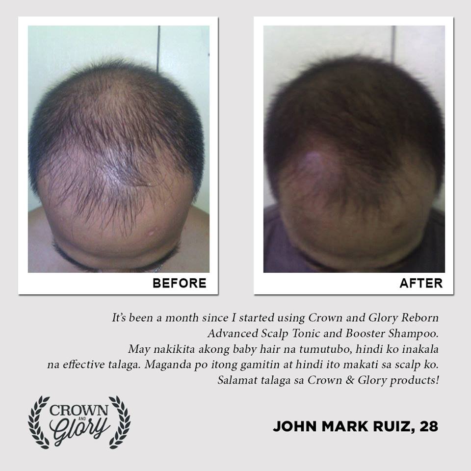 hair grower testimonial