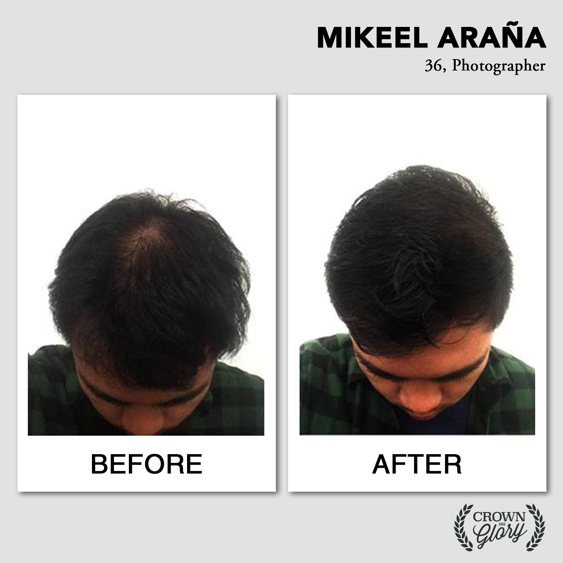 hair grower testimonial