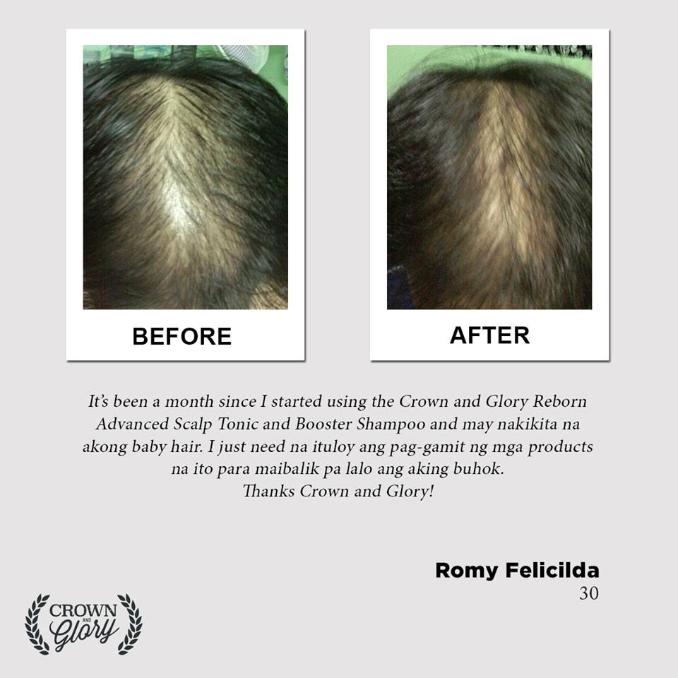 hair grower testimonial