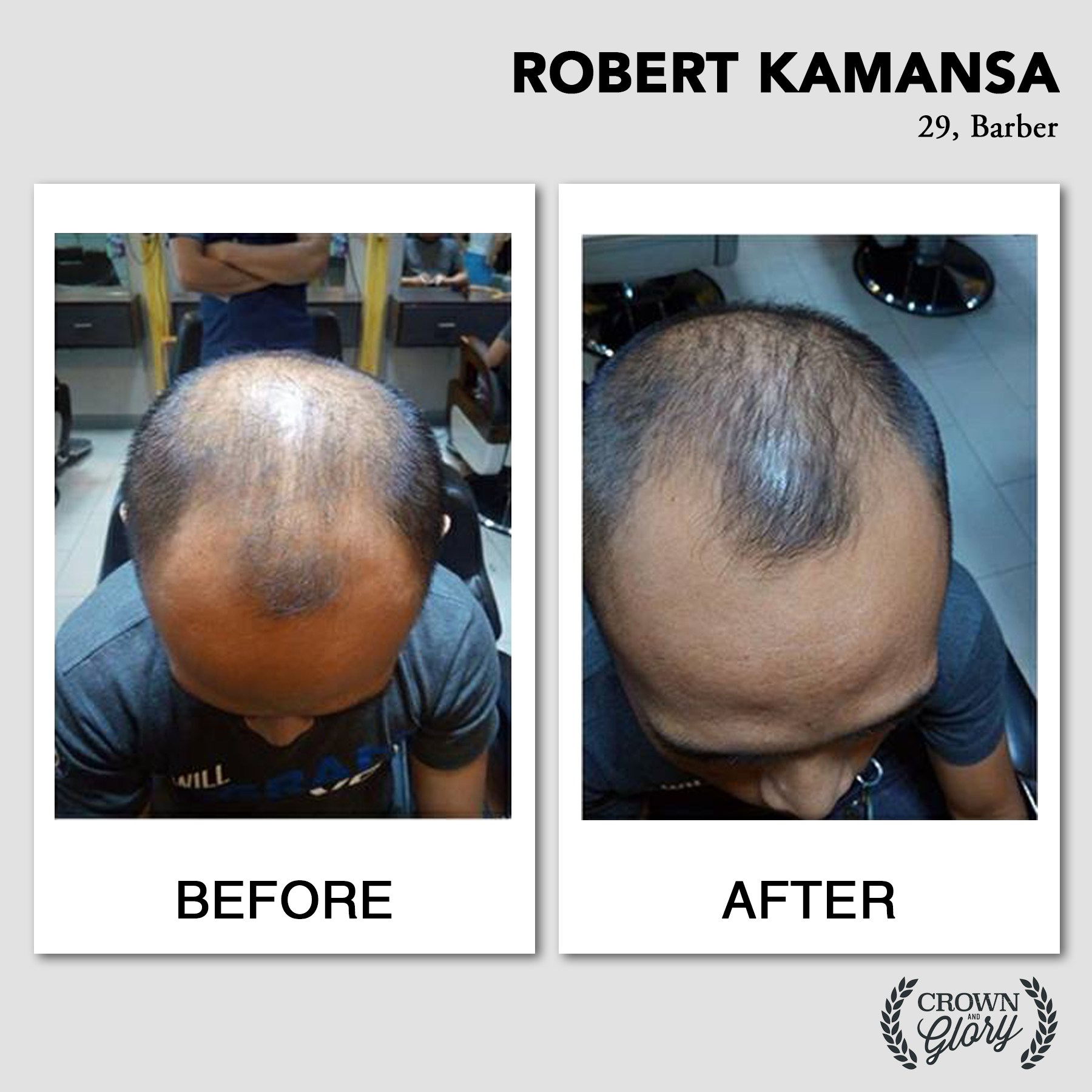 hair grower testimonial