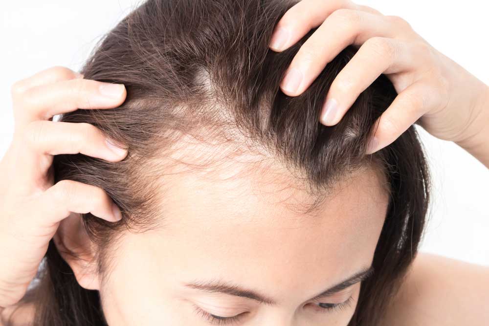 how to avoid hair fall how to avoid hair fall