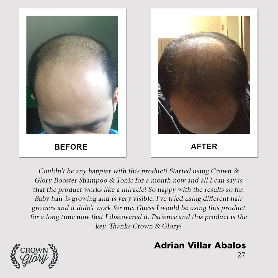 hair grower testimonial