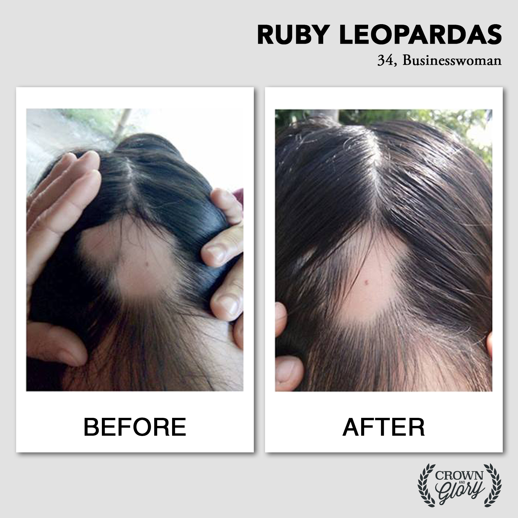 hair grower testimonial
