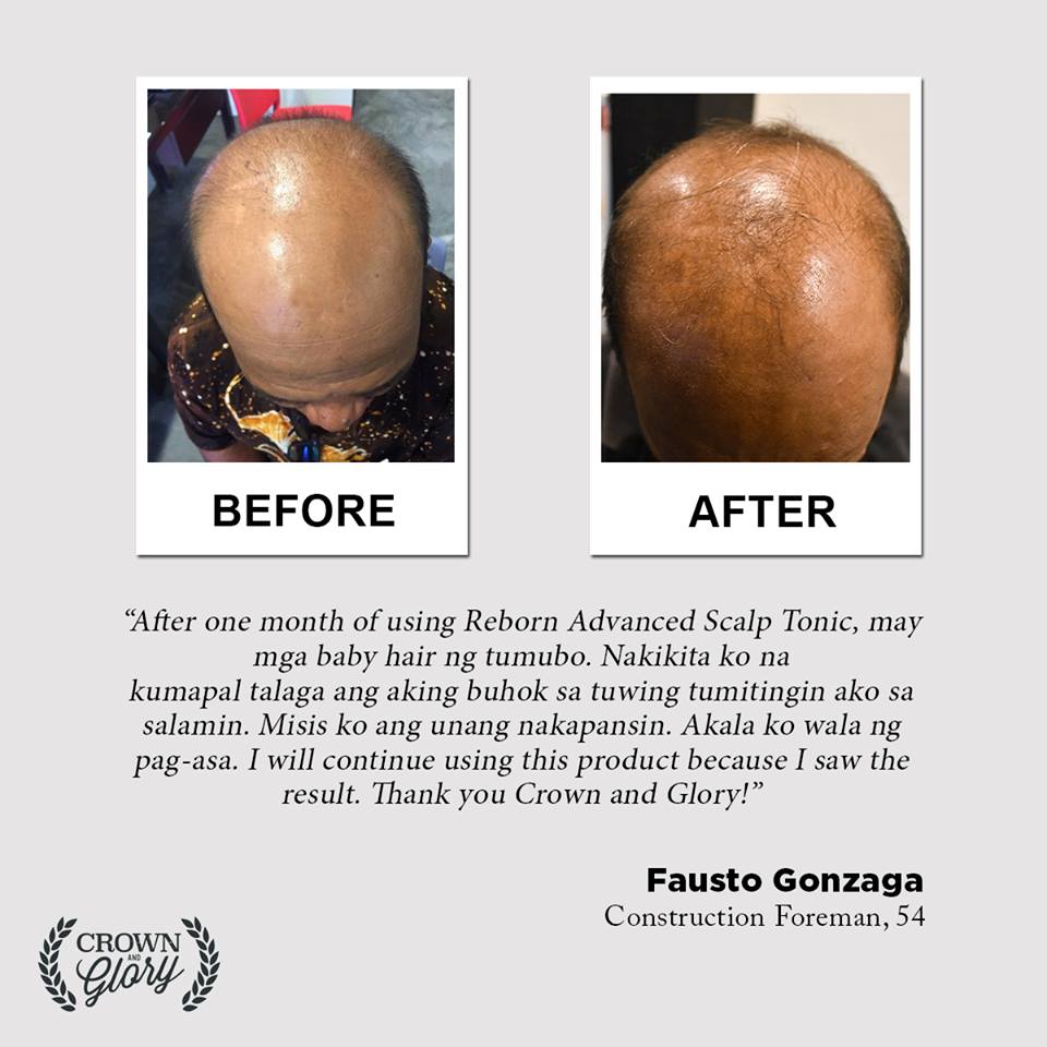 hair grower testimonial