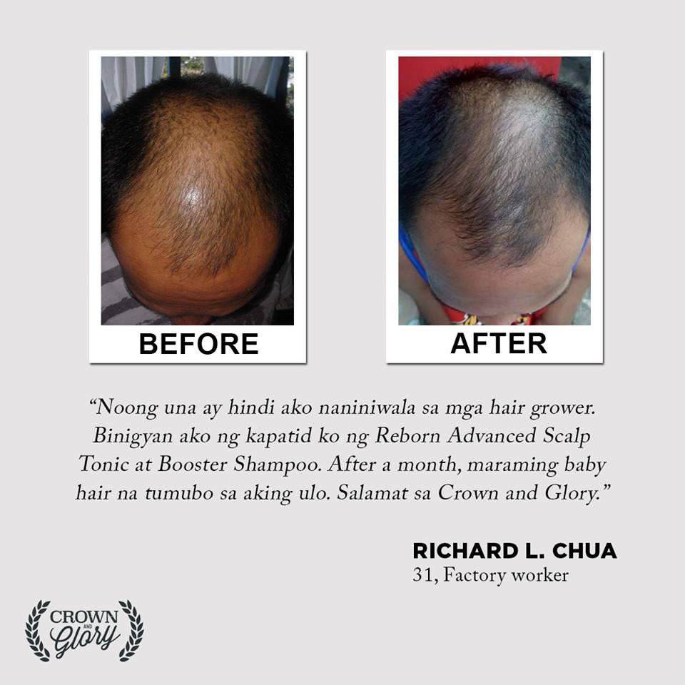 hair grower testimonial