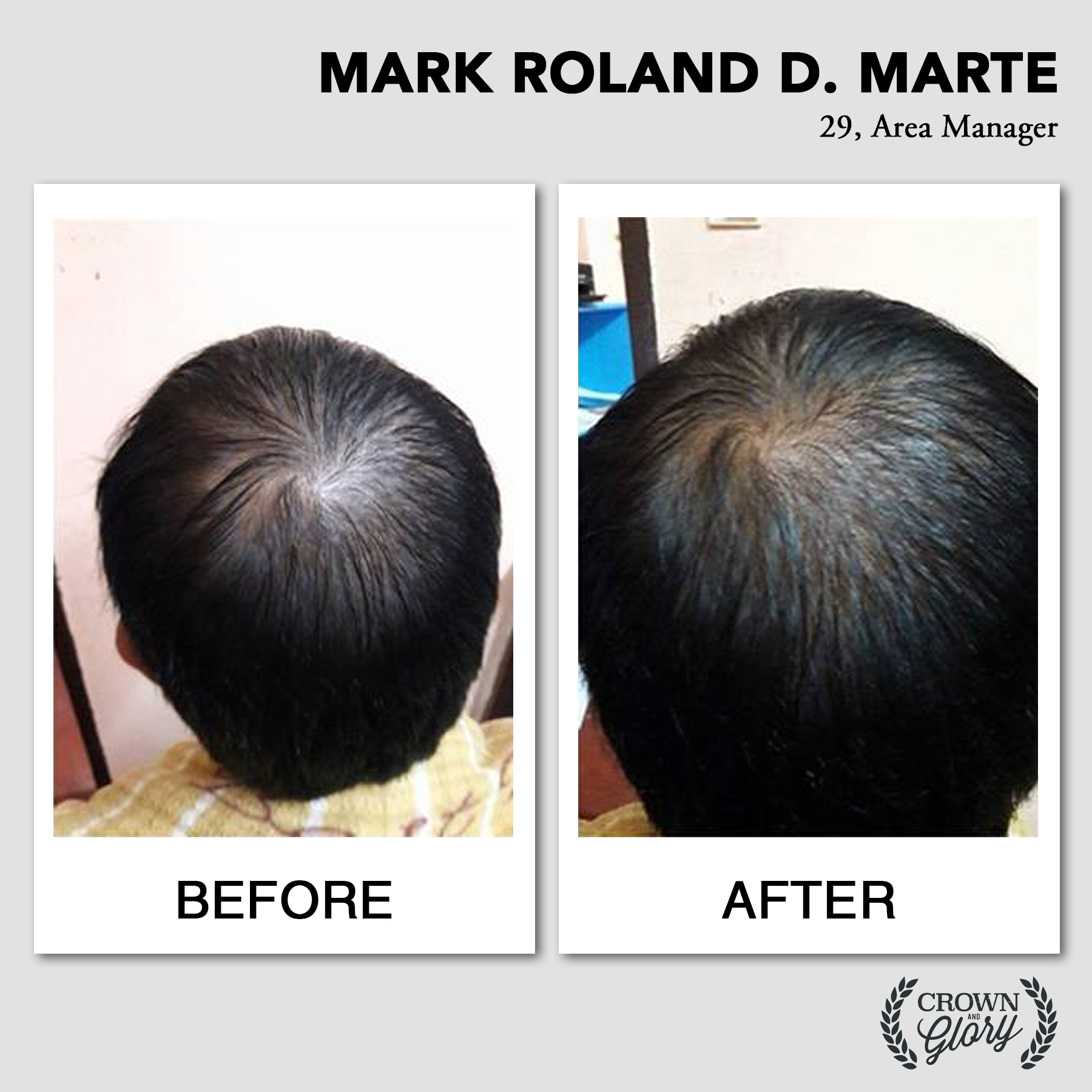 hair grower testimonial