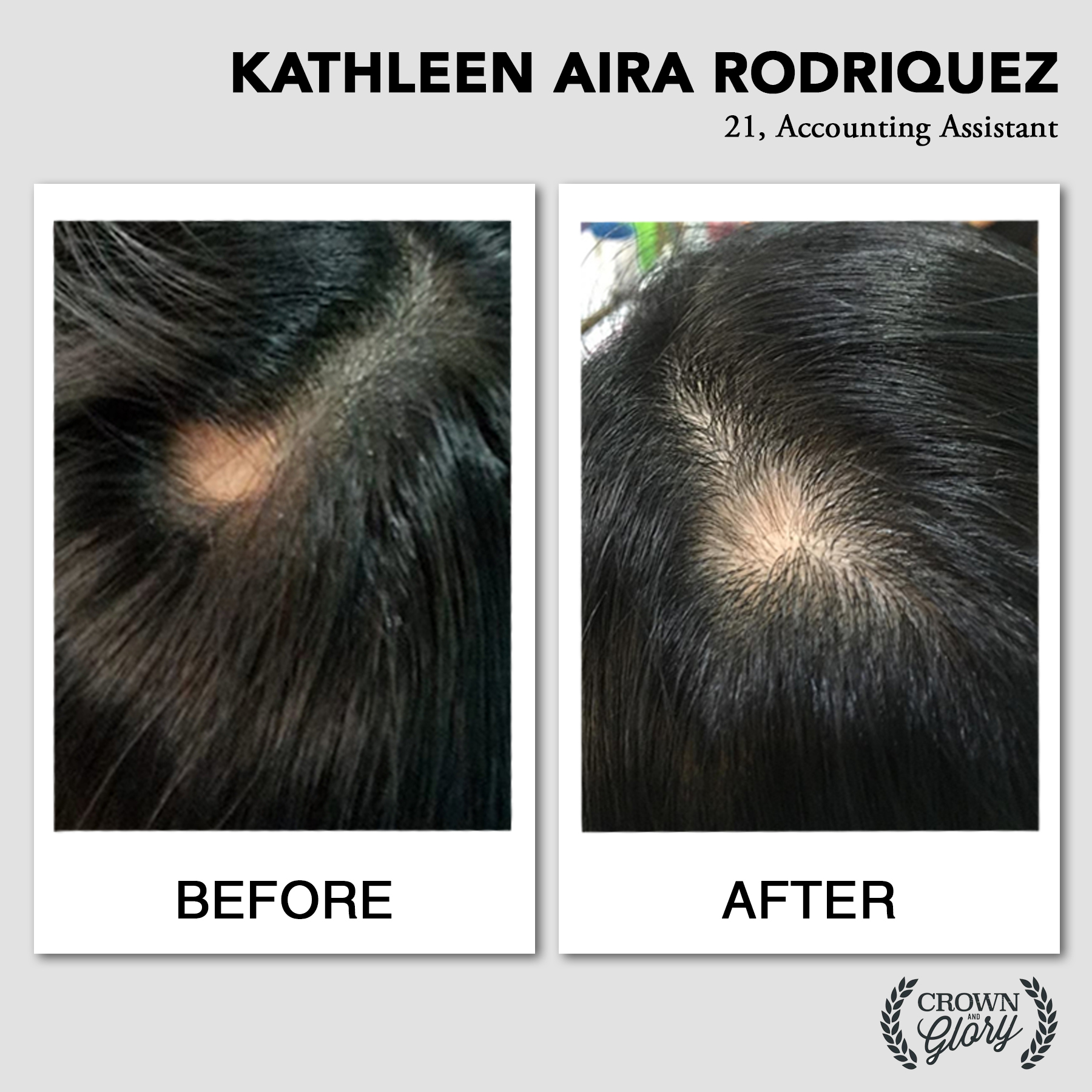 hair grower testimonial