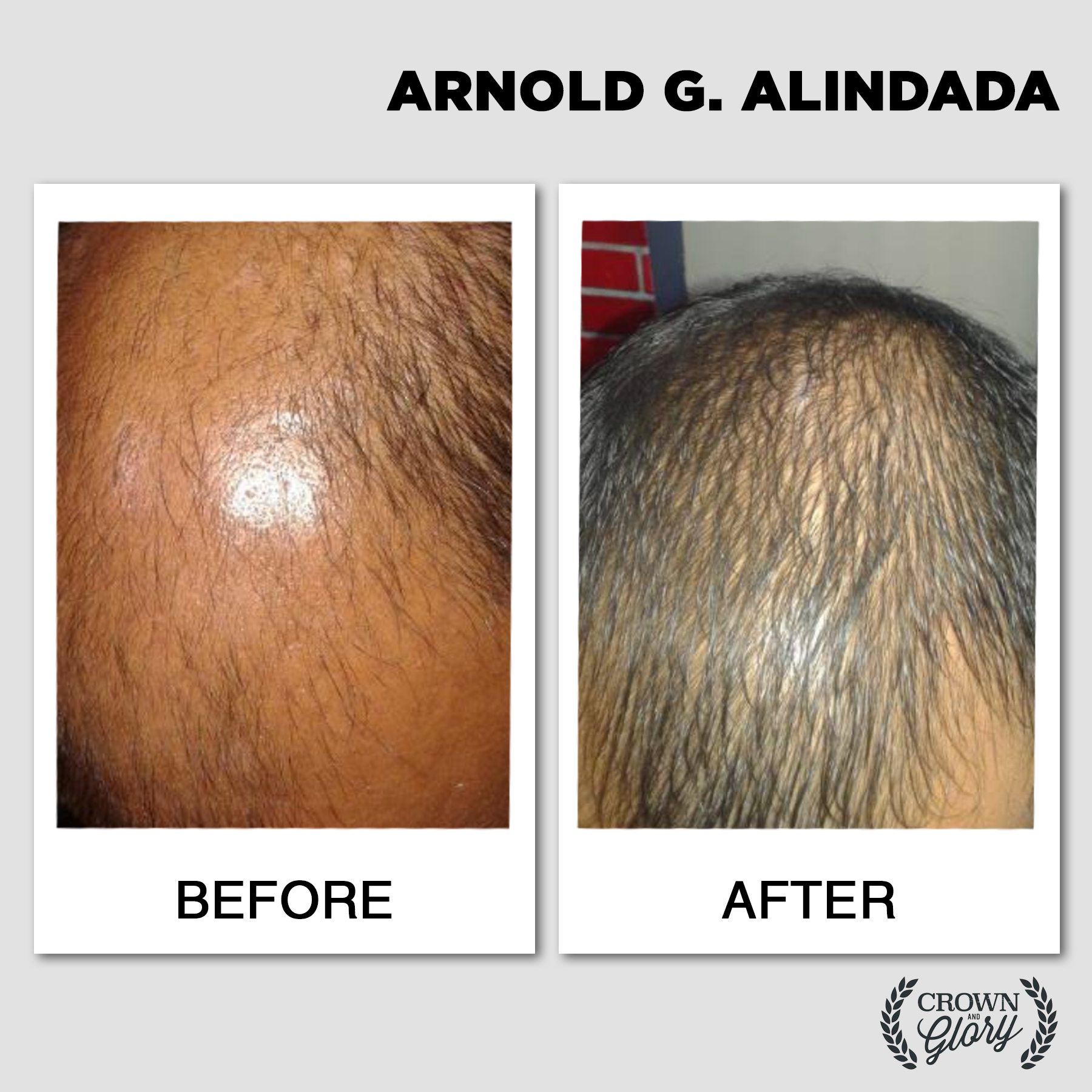 hair grower testimonial