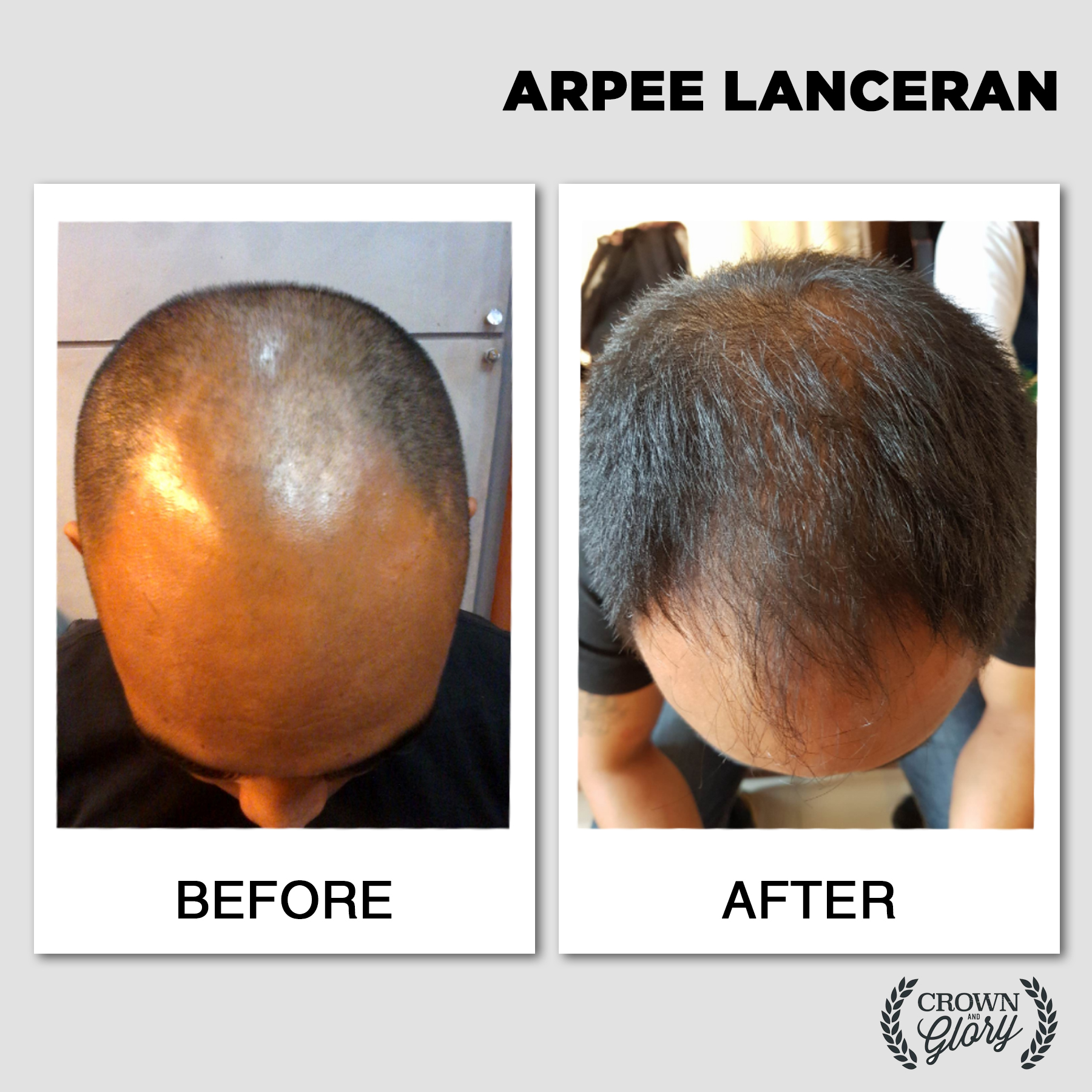 hair grower testimonial