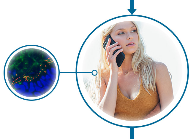 After - Without Full Spectrum 360˚ Protection After - Without Full Spectrum 360˚ Protection