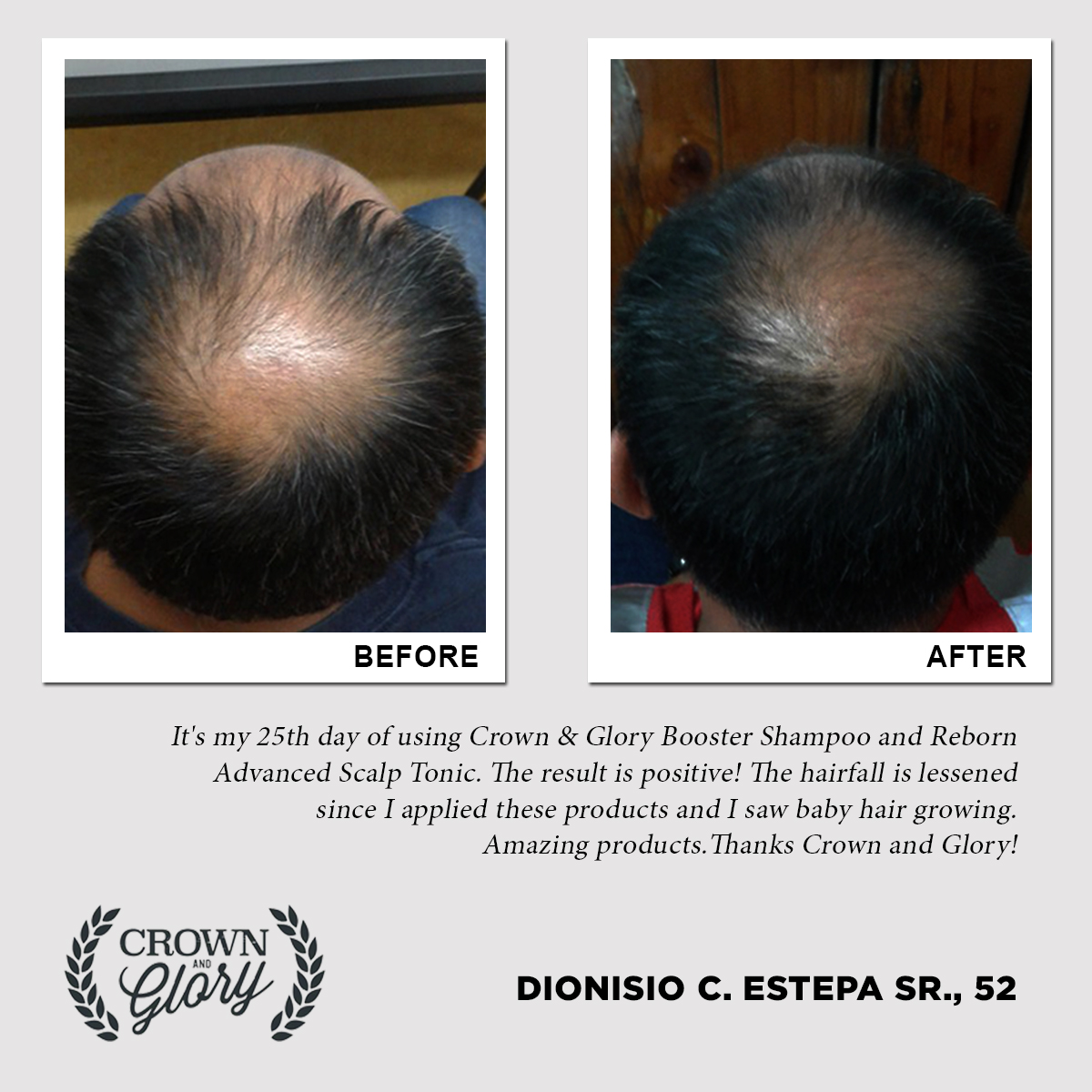 hair grower testimonial
