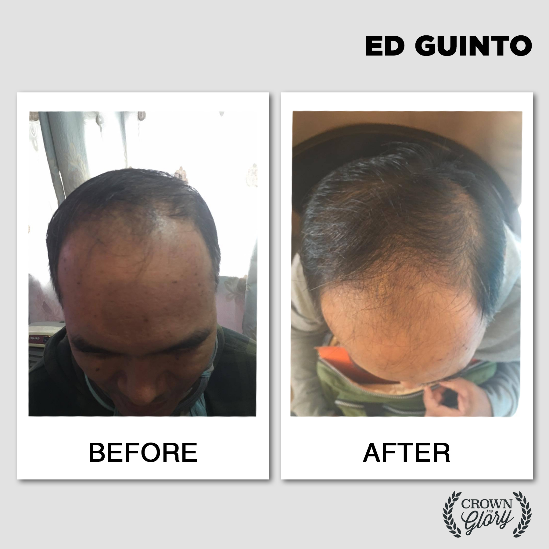 hair grower testimonial
