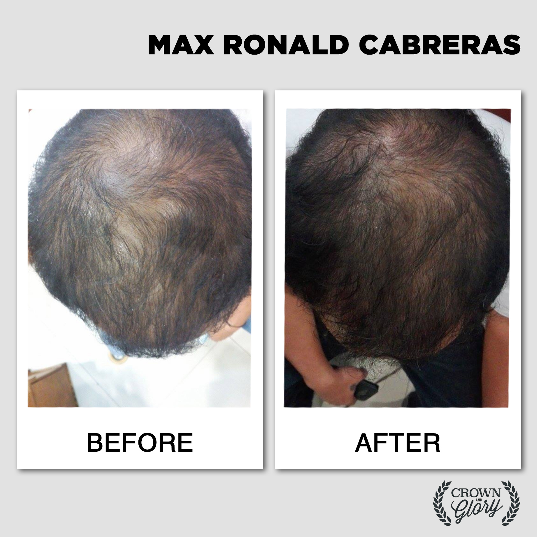 hair grower testimonial