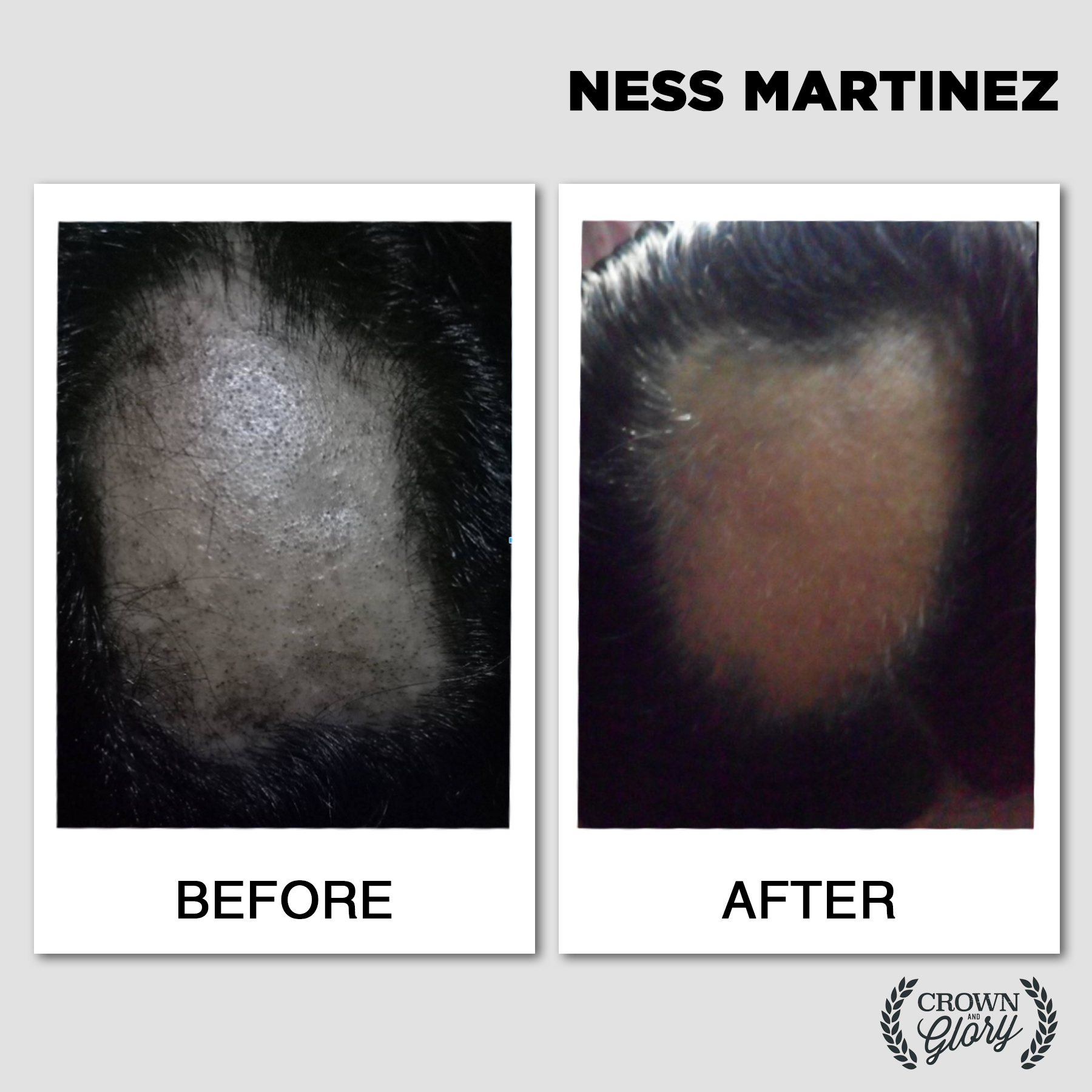 hair grower testimonial