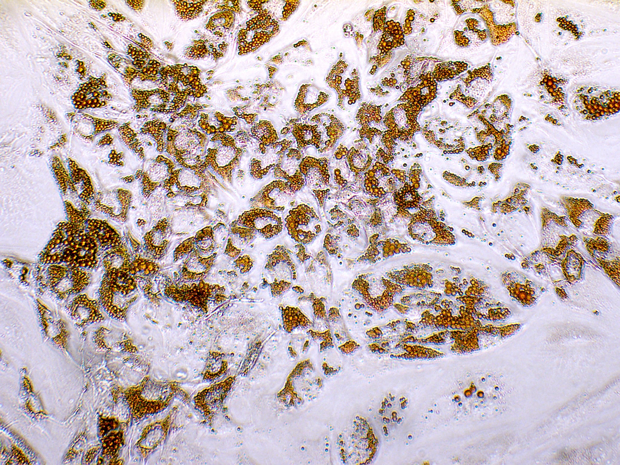 Microscope Photos of Adipogenic Differentiation of Mesenchymal Stem Cells with White Background