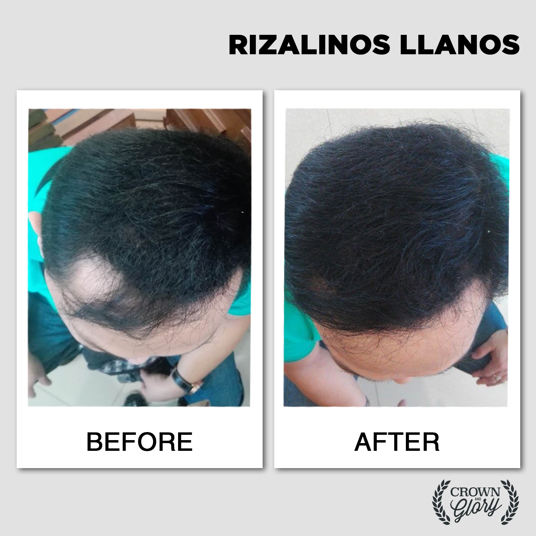 hair grower testimonial