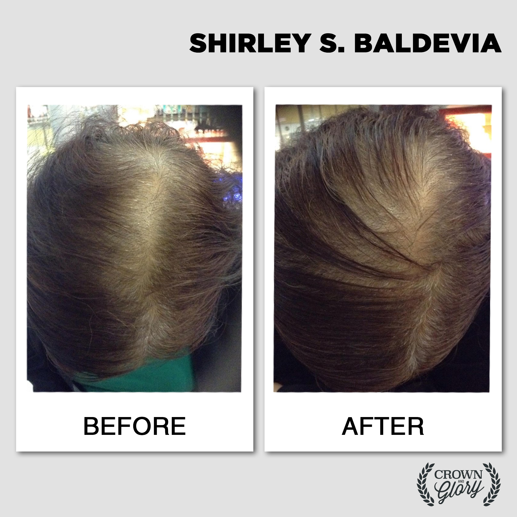 hair grower testimonial