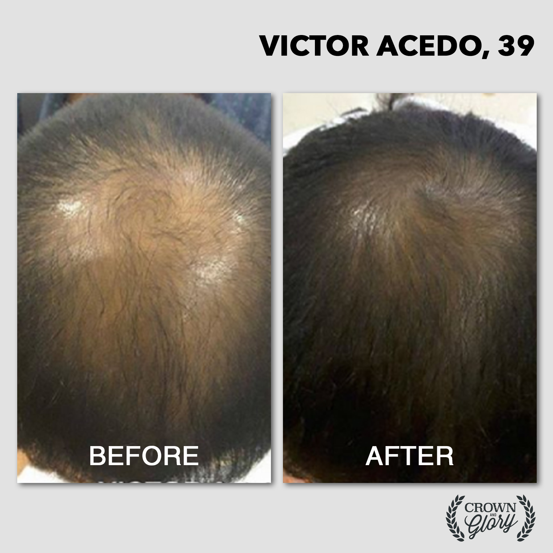 hair grower testimonial